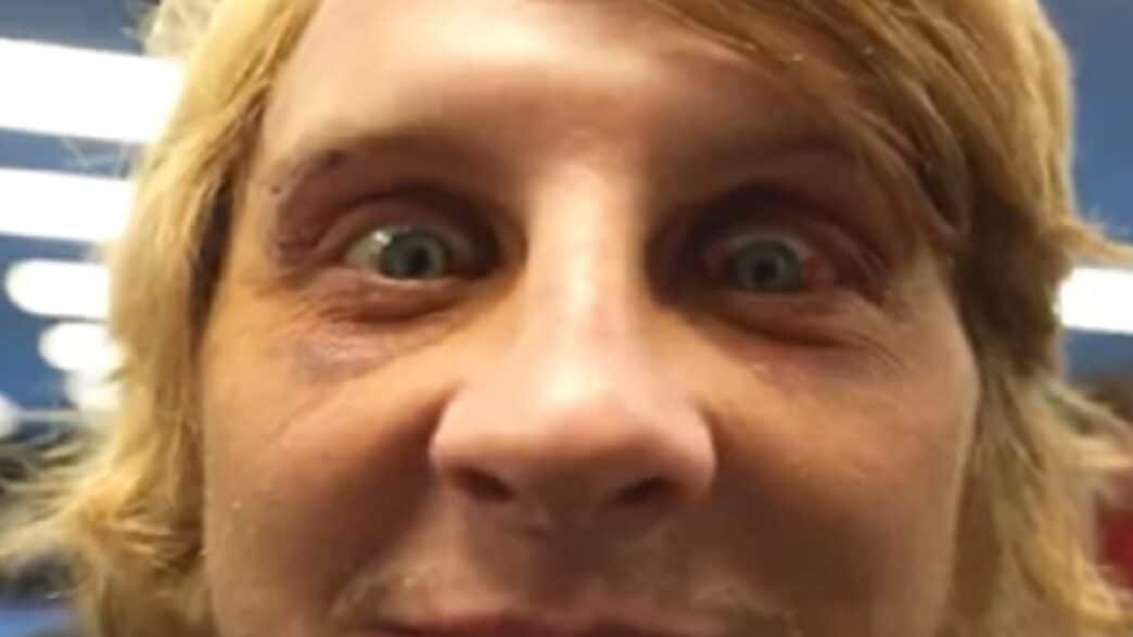 Paddy-Pimblett-Eyes