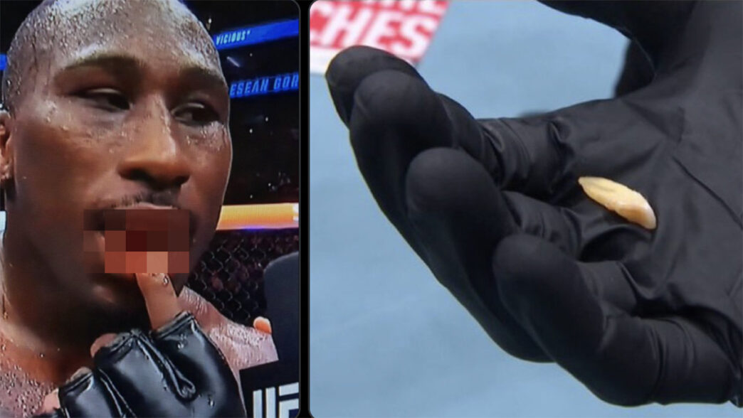 UFC 330 - Il perd ses dents et gagne quand même !
