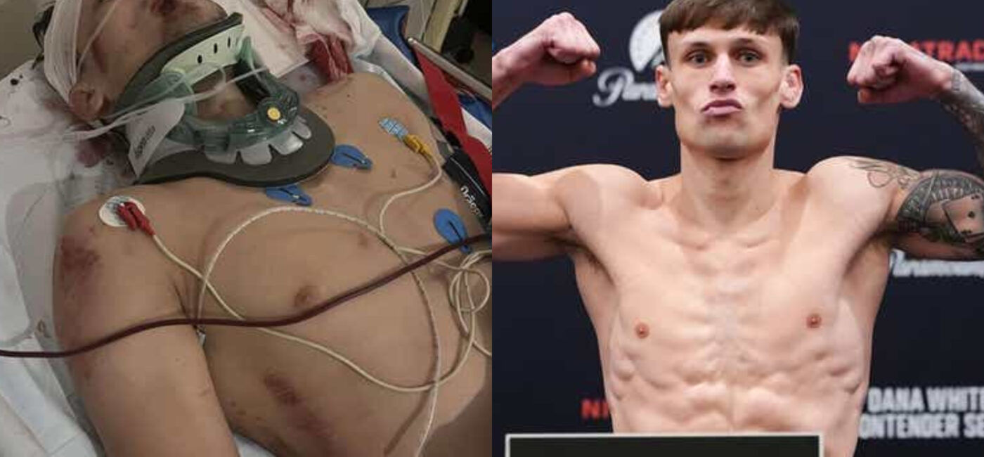 Un espoir de l'UFC revient de l’impossible après avoir été percuté par un bus : « Je devrais être mort »