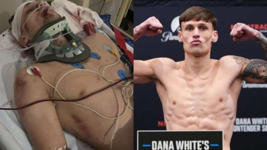Un espoir de l'UFC revient de l’impossible après avoir été percuté par un bus : « Je devrais être mort »