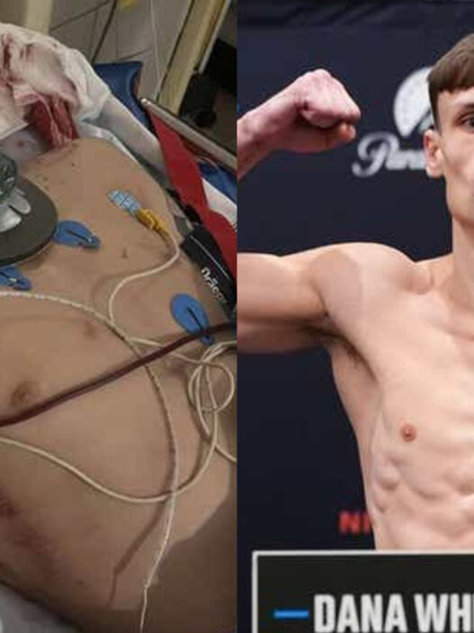Un espoir de l'UFC revient de l’impossible après avoir été percuté par un bus : « Je devrais être mort »