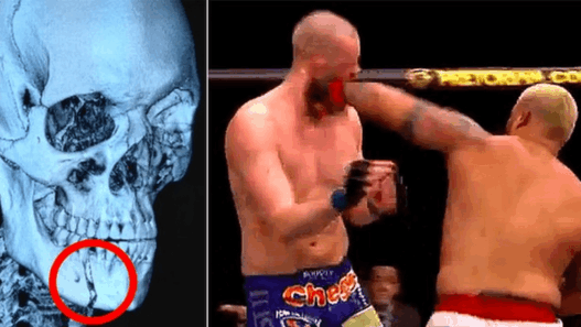 Le légendaire KO de Mark Hunt sur Stefan Struve