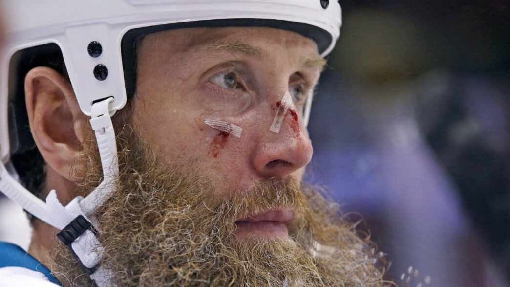 Joe Thornton a joué avec deux ligaments déchirés