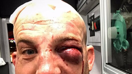 Patrick Cummins et sa nouvelle victoire au bout de sa vie