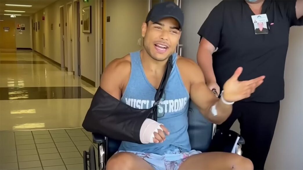 paulo costa main cassée