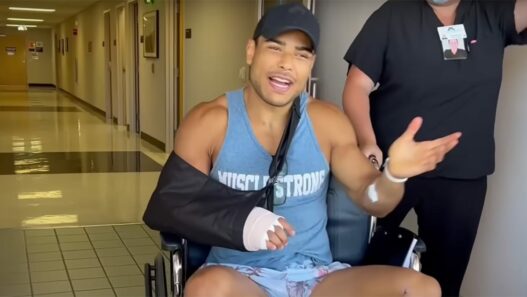 paulo costa main cassée