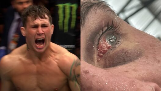darren till blessure œil