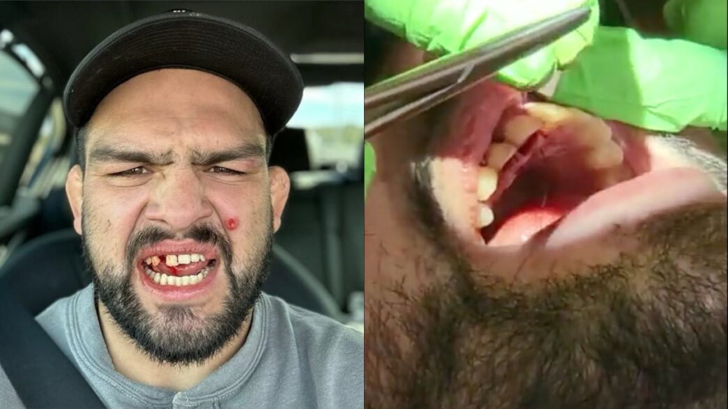 gastelum images opération