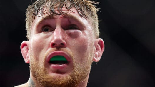 darren till rupture ufc