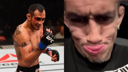 tony ferguson malade