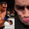 tony ferguson malade