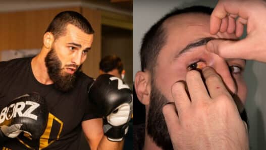 ibratv grave blessure