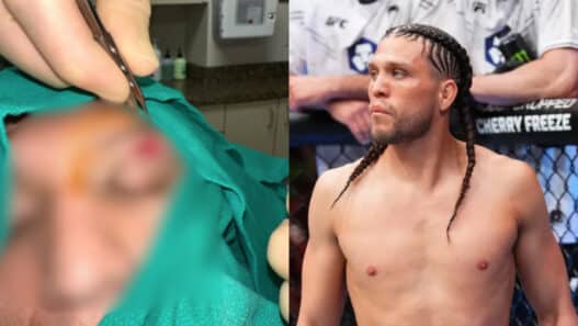 ortega blessure ufc mexique