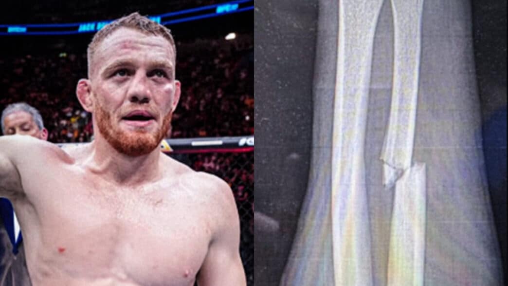 Jack-Della-Maddalena (1)