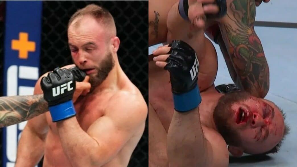 Rebecki défiguré hôpital