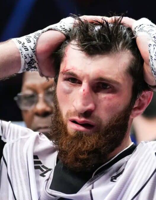 ankalaev blessure ufc 320