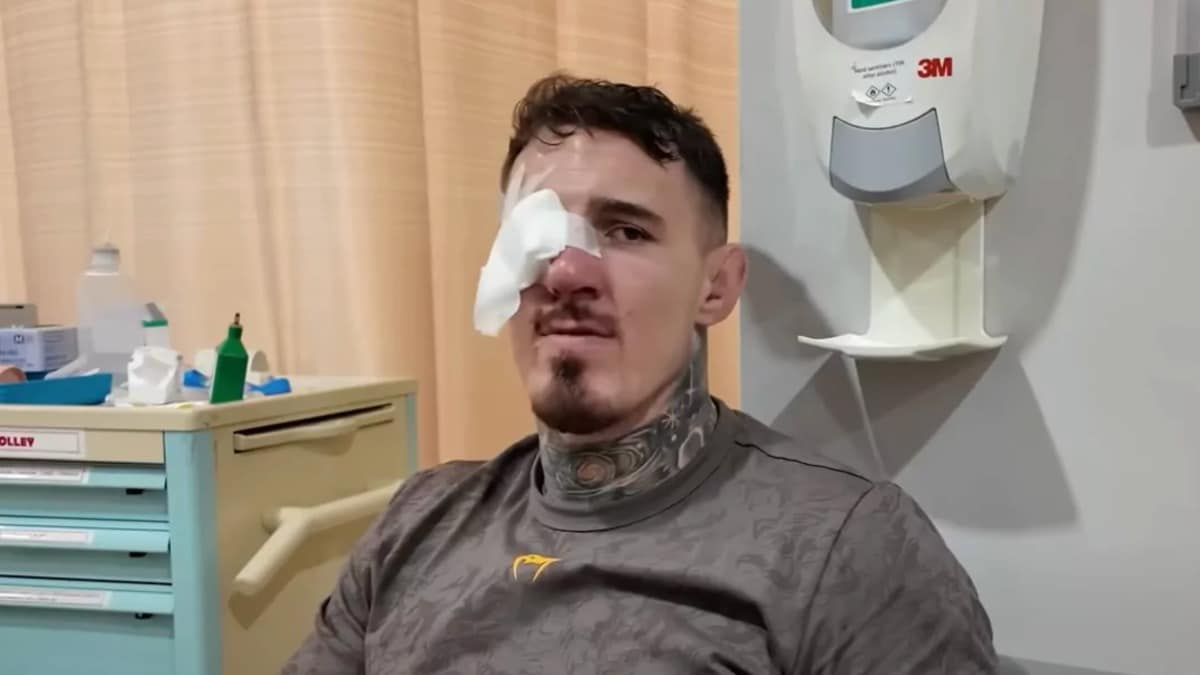 https://lasueur.com/wp-content/uploads/2025/10/tom-aspinall-yeux-blessure-grave.jpeg