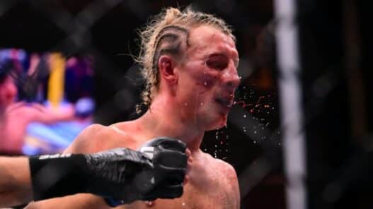 Le visage très amoché de Paddy Pimblett, 3 jours après l’UFC 324