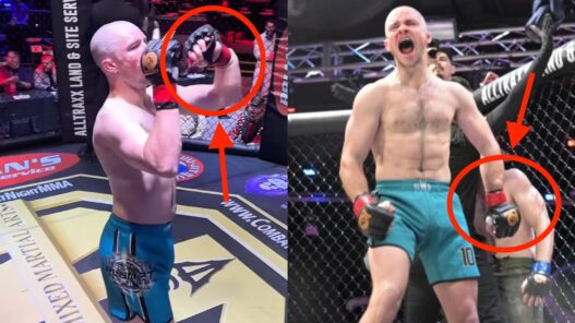 Il se brise le bras et gagne son combat sans s’en rendre compte