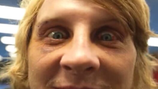 Paddy-Pimblett-Eyes