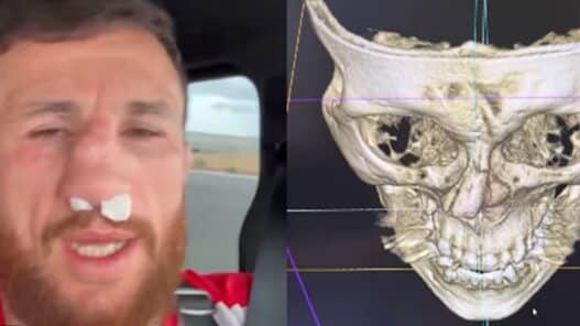 Merab Dvalishvili refuse une chirurgie et explique la raison