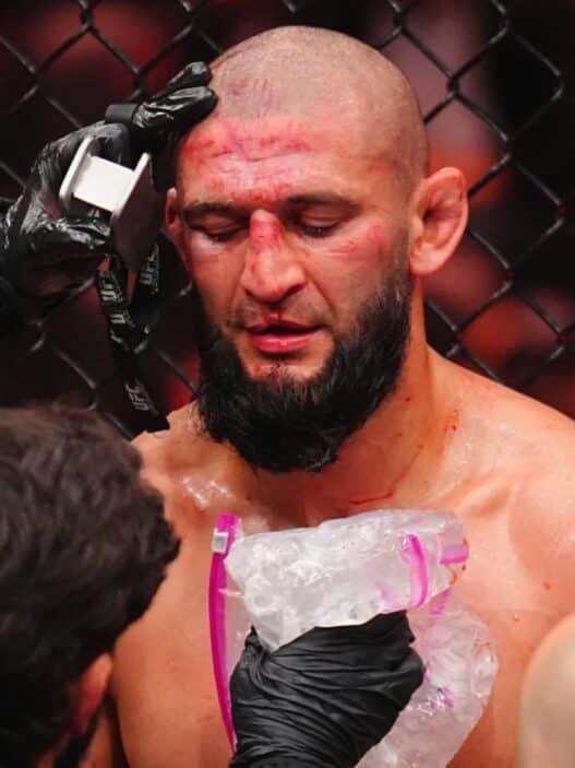 khamzat defigure 2 jours apres ufc 328