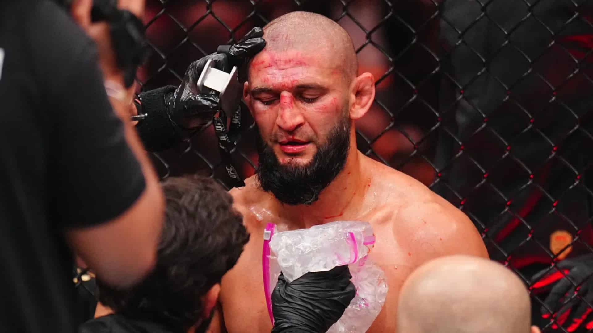 https://lasueur.com/wp-content/uploads/2026/05/khamzat-defigure-2-jours-apres-ufc-328.jpeg