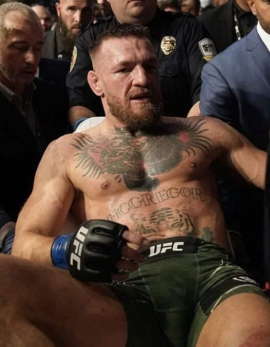 conor mcgregor blessure benediction