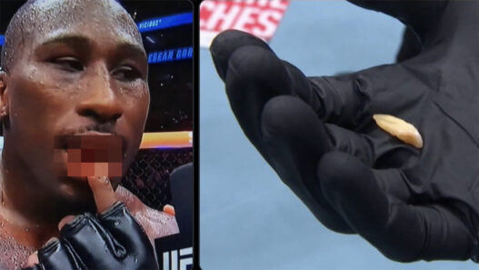 UFC 330 - Il perd ses dents et gagne quand m&ecirc;me !