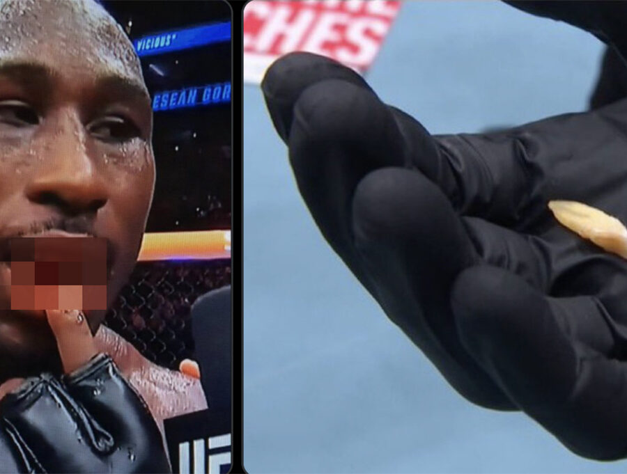UFC 330 - Il perd ses dents et gagne quand m&ecirc;me !