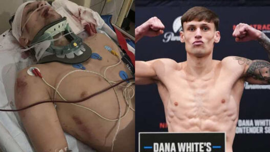Un espoir de l'UFC revient de l&rsquo;impossible apr&egrave;s avoir &eacute;t&eacute; percut&eacute; par un bus : &laquo; Je devrais &ecirc;tre mort &raquo;